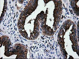 LGALS3BP Antibody in Immunohistochemistry (Paraffin) (IHC (P))