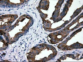 LGALS3BP Antibody in Immunohistochemistry (Paraffin) (IHC (P))