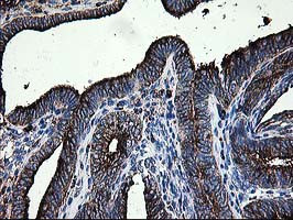 LGALS3BP Antibody in Immunohistochemistry (Paraffin) (IHC (P))