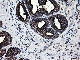 LGALS3BP Antibody in Immunohistochemistry (Paraffin) (IHC (P))