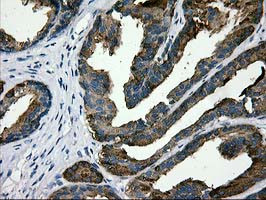 LGALS3BP Antibody in Immunohistochemistry (Paraffin) (IHC (P))