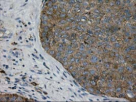 LGALS3BP Antibody in Immunohistochemistry (Paraffin) (IHC (P))