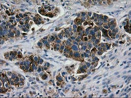 LGALS3BP Antibody in Immunohistochemistry (Paraffin) (IHC (P))