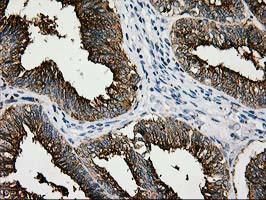 LGALS3BP Antibody in Immunohistochemistry (Paraffin) (IHC (P))