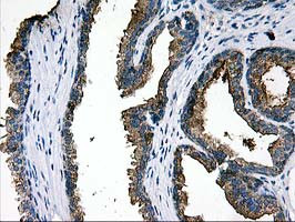 LGALS3BP Antibody in Immunohistochemistry (Paraffin) (IHC (P))