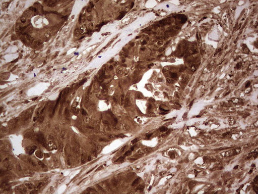 LGALS9 Antibody in Immunohistochemistry (Paraffin) (IHC (P))