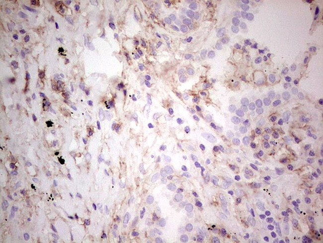 LGALS9 Antibody in Immunohistochemistry (Paraffin) (IHC (P))