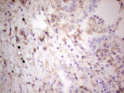 LGALS9 Antibody in Immunohistochemistry (Paraffin) (IHC (P))