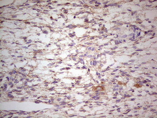 LGALS9 Antibody in Immunohistochemistry (Paraffin) (IHC (P))