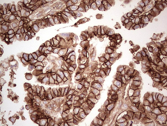 LGALS9 Antibody in Immunohistochemistry (Paraffin) (IHC (P))