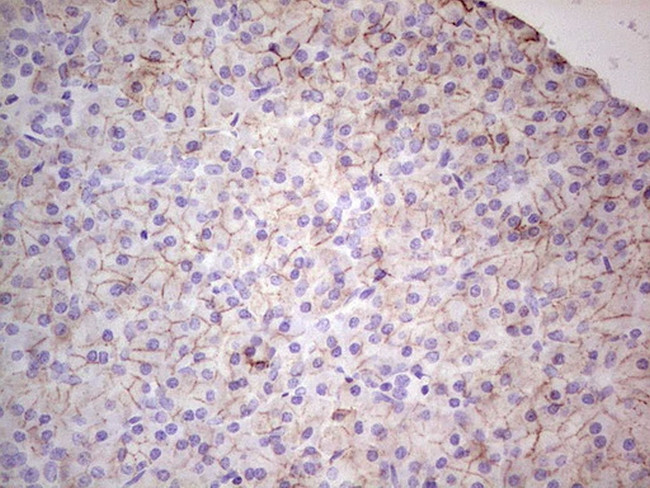 LGALS9 Antibody in Immunohistochemistry (Paraffin) (IHC (P))