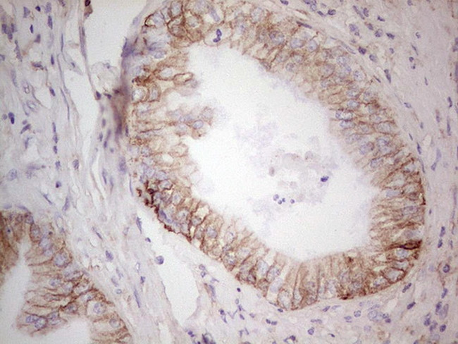 LGALS9 Antibody in Immunohistochemistry (Paraffin) (IHC (P))