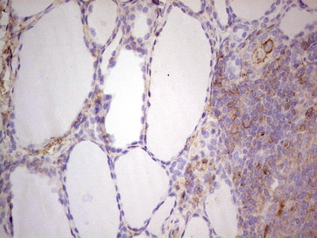 LGALS9 Antibody in Immunohistochemistry (Paraffin) (IHC (P))