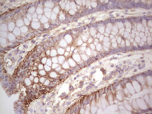 LGALS9 Antibody in Immunohistochemistry (Paraffin) (IHC (P))