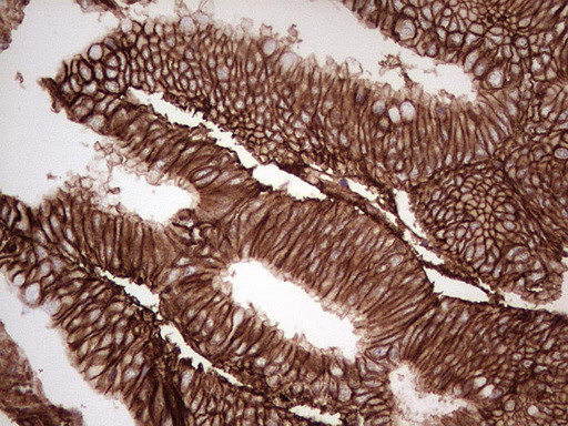 LGALS9 Antibody in Immunohistochemistry (Paraffin) (IHC (P))