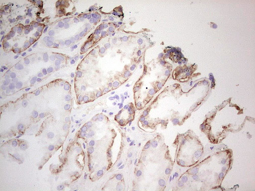 LGALS9 Antibody in Immunohistochemistry (Paraffin) (IHC (P))