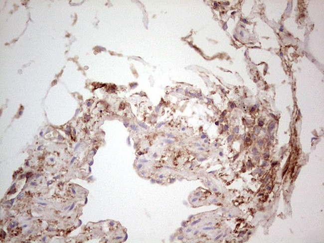 LGALS9 Antibody in Immunohistochemistry (Paraffin) (IHC (P))