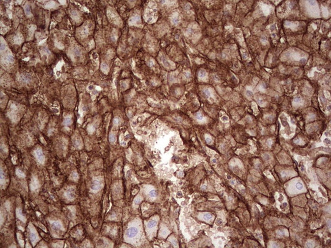 LGALS9 Antibody in Immunohistochemistry (Paraffin) (IHC (P))