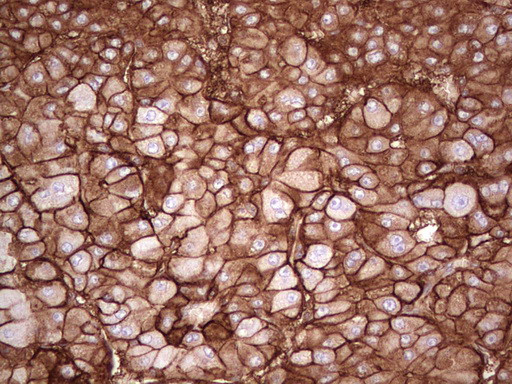 LGALS9 Antibody in Immunohistochemistry (Paraffin) (IHC (P))