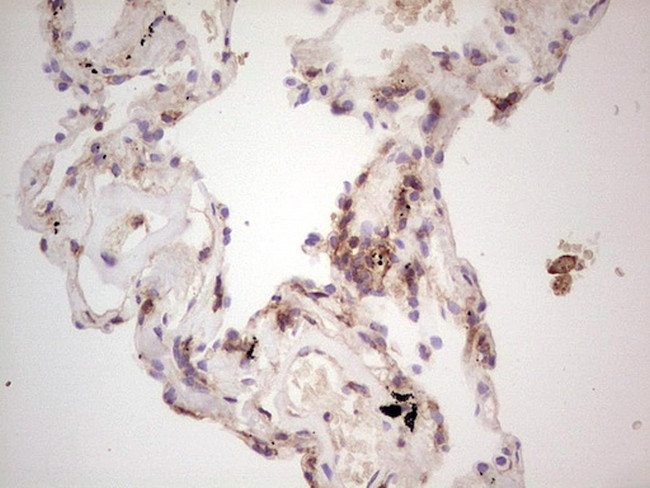 LGALS9 Antibody in Immunohistochemistry (Paraffin) (IHC (P))