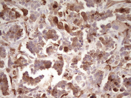 LGALS9 Antibody in Immunohistochemistry (Paraffin) (IHC (P))