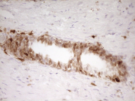 LGALS9 Antibody in Immunohistochemistry (Paraffin) (IHC (P))