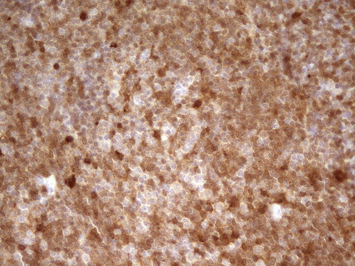 LGALS9 Antibody in Immunohistochemistry (Paraffin) (IHC (P))