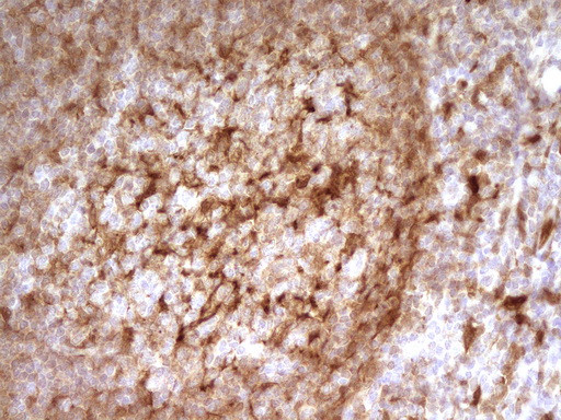 LGALS9 Antibody in Immunohistochemistry (Paraffin) (IHC (P))