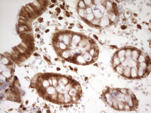 LGALS9 Antibody in Immunohistochemistry (Paraffin) (IHC (P))