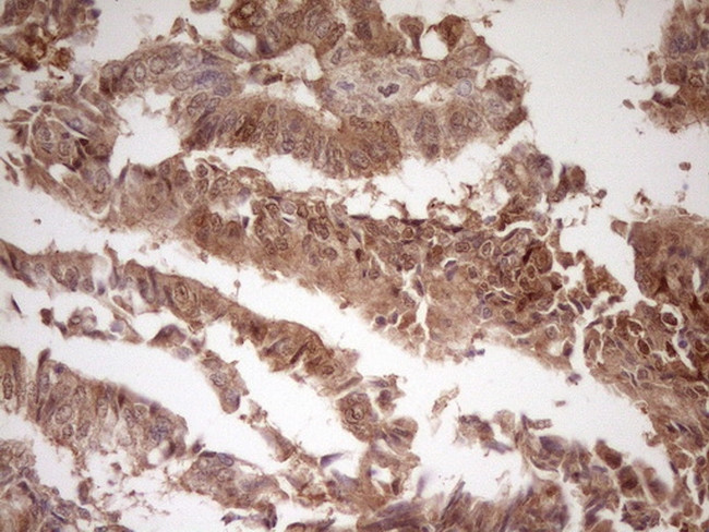 LGALS9 Antibody in Immunohistochemistry (Paraffin) (IHC (P))