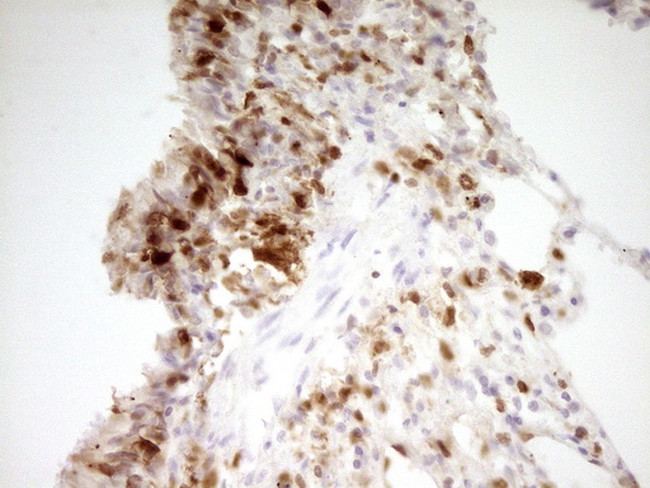 LGALS9 Antibody in Immunohistochemistry (Paraffin) (IHC (P))