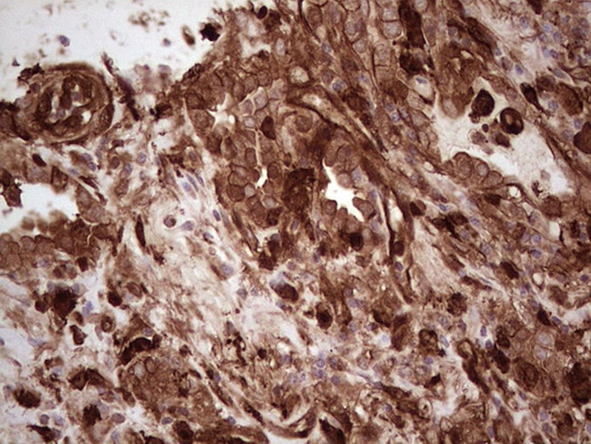 LGALS9 Antibody in Immunohistochemistry (Paraffin) (IHC (P))