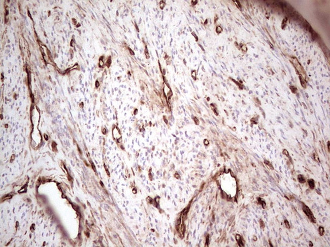 LGALS9 Antibody in Immunohistochemistry (Paraffin) (IHC (P))