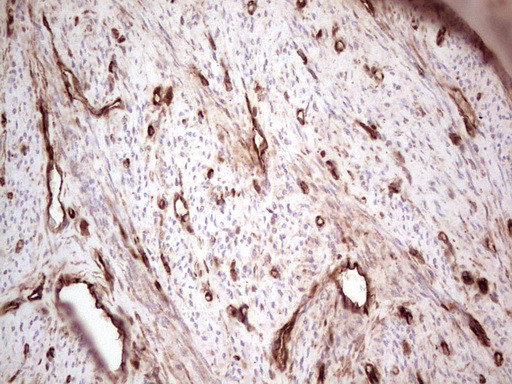 LGALS9 Antibody in Immunohistochemistry (Paraffin) (IHC (P))