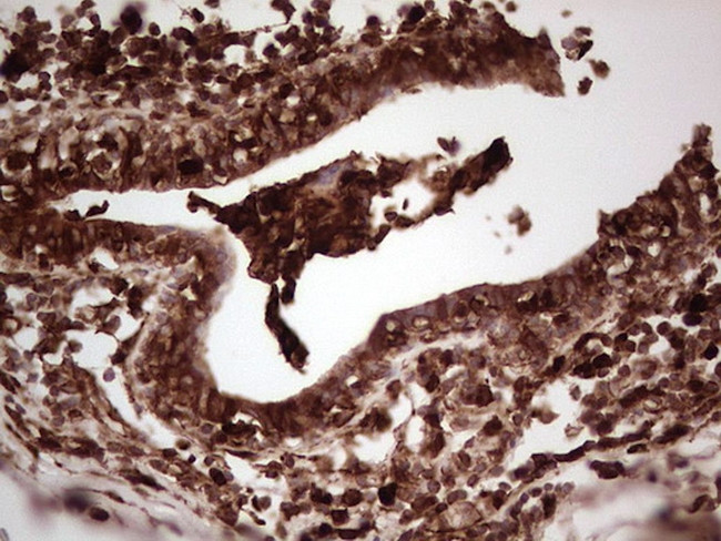 LGALS9 Antibody in Immunohistochemistry (Paraffin) (IHC (P))