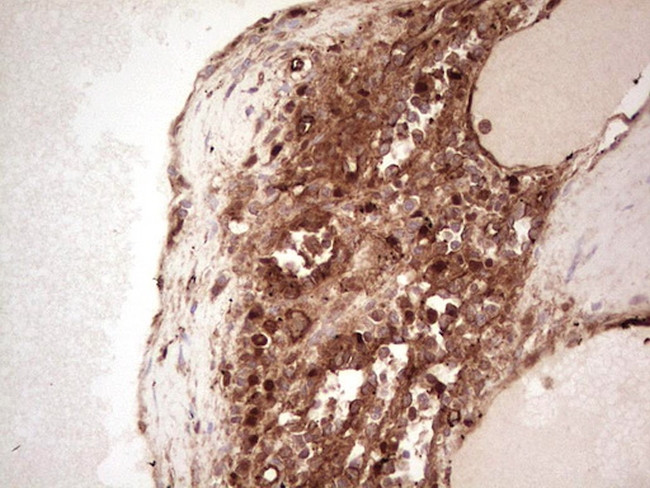 LGALS9 Antibody in Immunohistochemistry (Paraffin) (IHC (P))