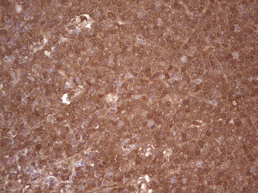 LGALS9 Antibody in Immunohistochemistry (Paraffin) (IHC (P))