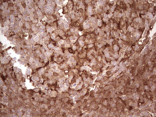 LGALS9 Antibody in Immunohistochemistry (Paraffin) (IHC (P))