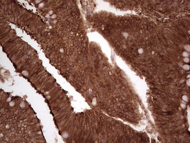 LGALS9 Antibody in Immunohistochemistry (Paraffin) (IHC (P))