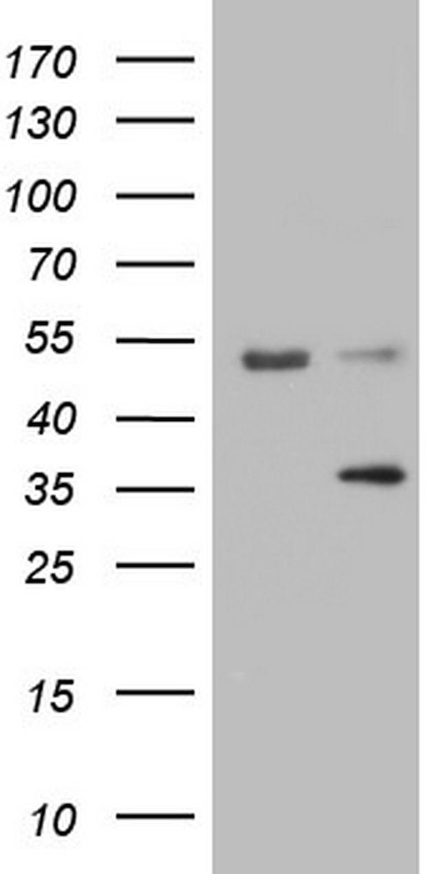 LGALS9 Antibody in Western Blot (WB)