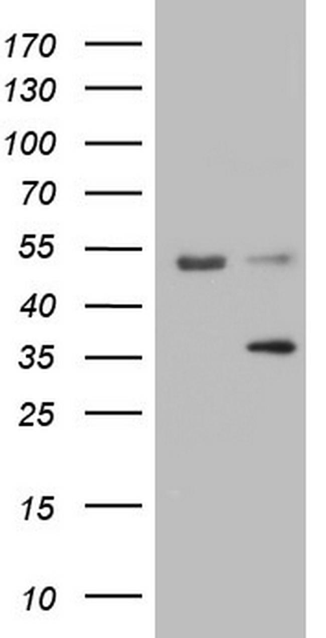 LGALS9 Antibody in Western Blot (WB)