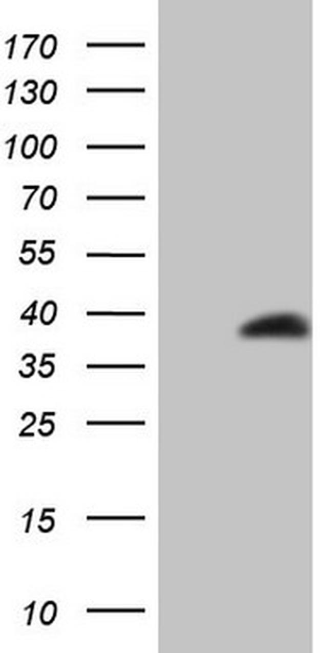 LGALS9 Antibody in Western Blot (WB)