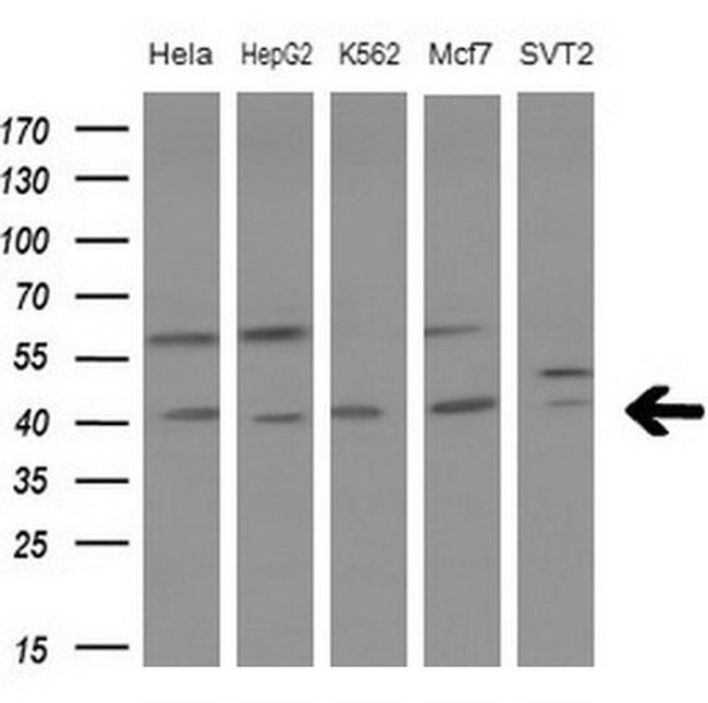 LGALS9 Antibody in Western Blot (WB)