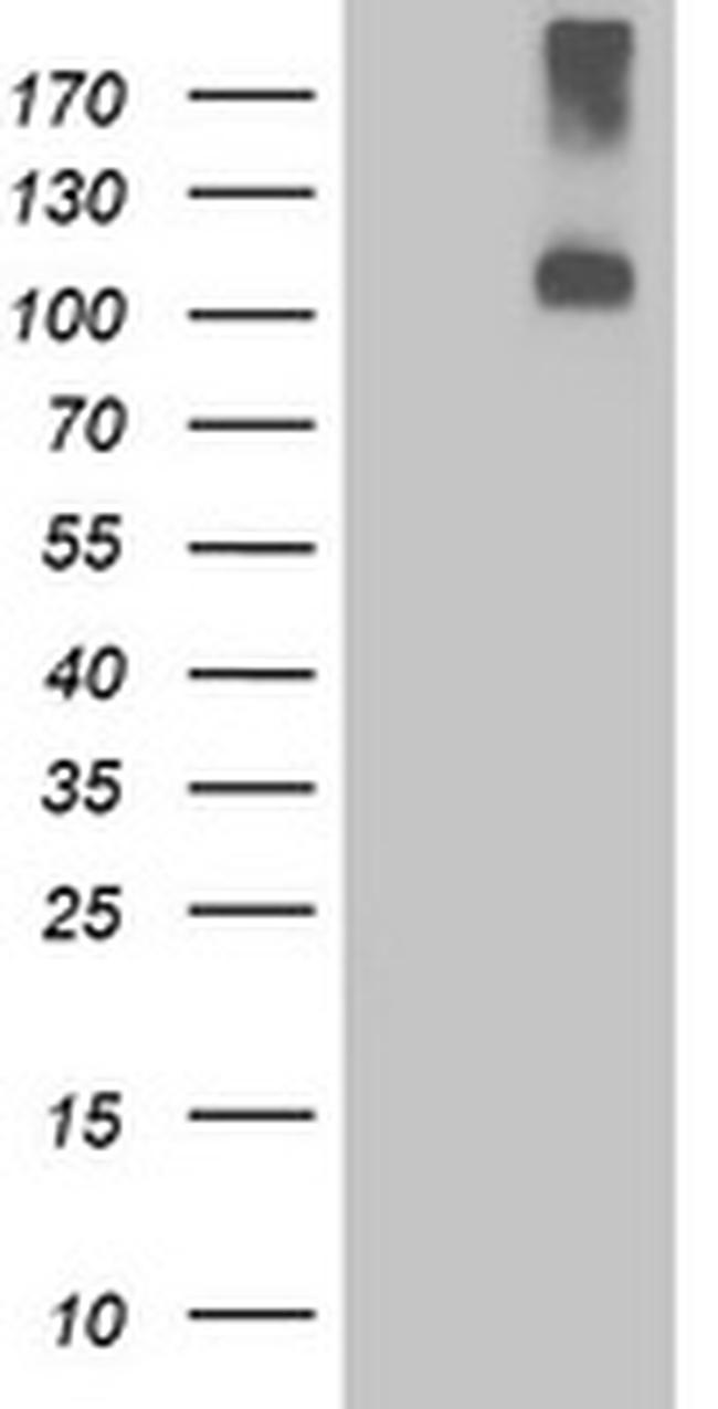 LGR4 Antibody in Western Blot (WB)