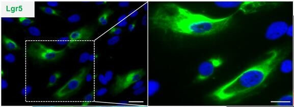 LGR5 Antibody in Immunocytochemistry (ICC/IF)