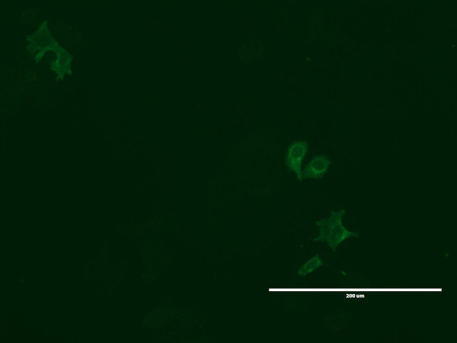 LGR5 Antibody in Immunocytochemistry (ICC/IF)