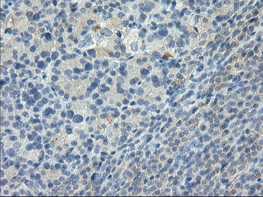 LGR5 Antibody in Immunohistochemistry (Paraffin) (IHC (P))