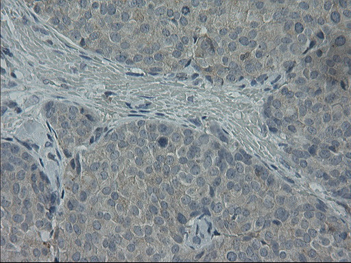 LGR5 Antibody in Immunohistochemistry (Paraffin) (IHC (P))