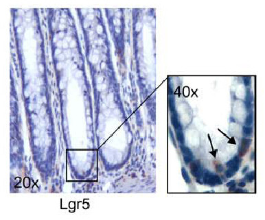 LGR5 Antibody in Immunohistochemistry (Paraffin) (IHC (P))