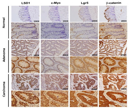 LGR5 Antibody in Immunohistochemistry (Paraffin) (IHC (P))